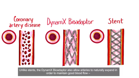 What is Coronary Artery Disease and Why Treating it with a Bioadaptor Matters? 