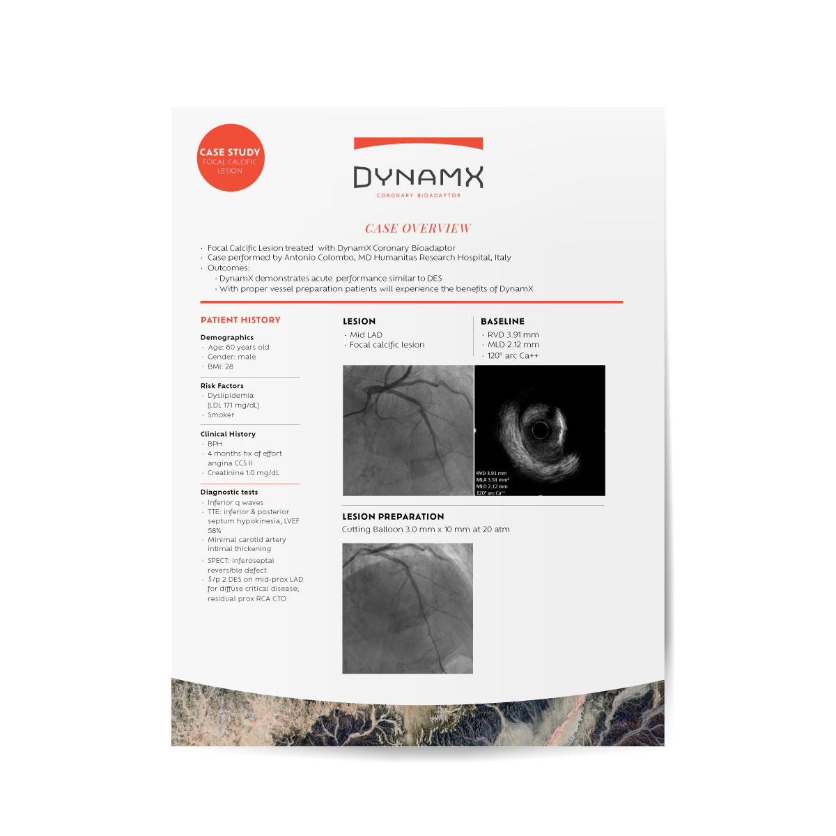 Case Study: Focal Calcific Lesion